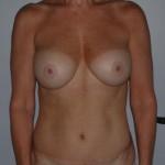 charleston breast surgeons